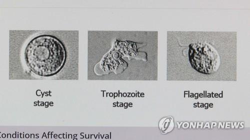 대만 30대 여성, '뇌 먹는 아메바' 감염으로 7일만에 사망