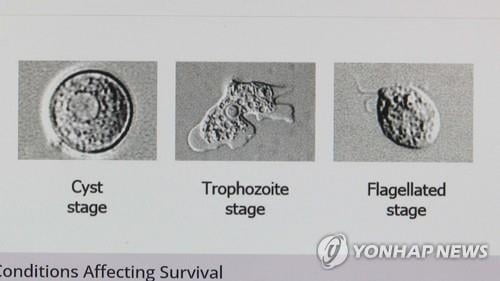 물놀이장 갔다가…"뇌 먹는 아메바"에 감염 사망