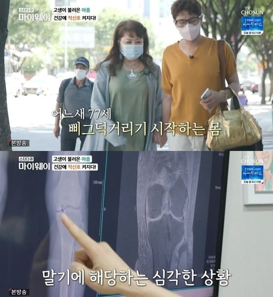 "Divorce with 10 billion debt" Jang Mi-hwa, degenerative arthritis 3rd term "I can't last long" shock