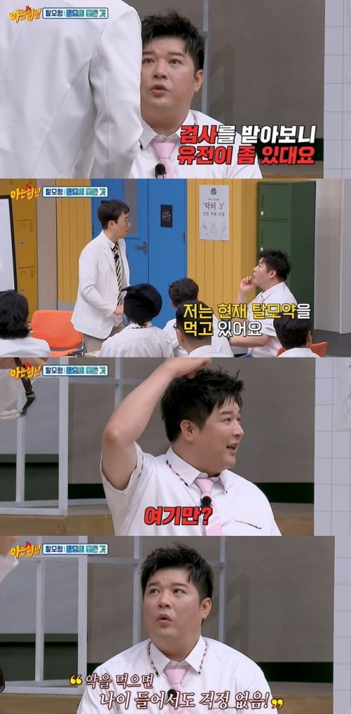 Shindong "Actually, I'm taking hair loss medicine... It's genetic" surprise confession