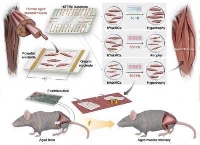 [사이테크+] "최적화 전기자극, 노화 근육 회복 효과"…근감소증 치료 가능성