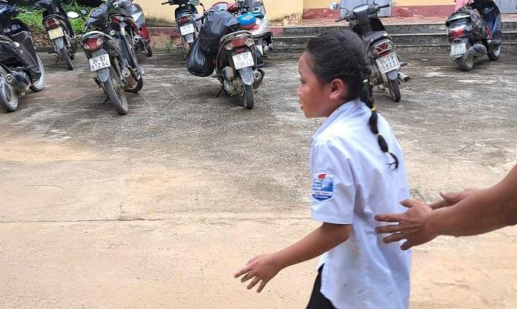 개학식 장식으로 설치된 수소 풍선이 폭발하면서 화상을 입은 베트남 초등학생. /사진=연합뉴스 