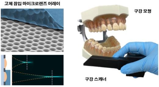 '치아 본뜰 때 하는 3차원 구강 스캐닝을 휴대용 카메라로'