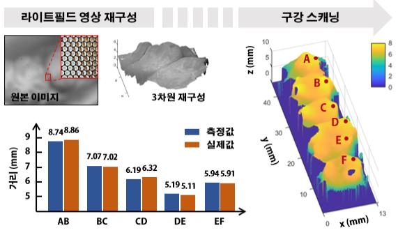 '치아 본뜰 때 하는 3차원 구강 스캐닝을 휴대용 카메라로'