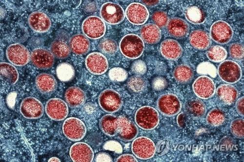 중국 8월 엠폭스 신규 감염 501명…확산세 지속
