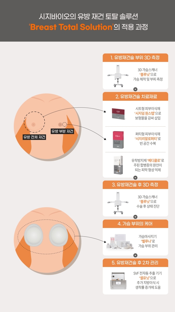 시지바이오 "유방 재건 최적화된 토탈 설루션 개발"