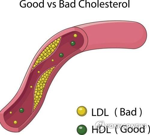 "HDL 콜레스테롤 수치 높아도 치매 위험"