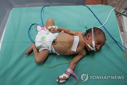 [이·팔 전쟁] 연료 바닥나는 병원들…"아기들 죽음 보고만 있을 건가"