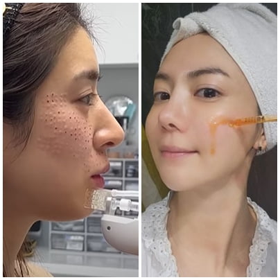 Min Hye-yeon's confident confession as a wife undergoing surgery while bleeding