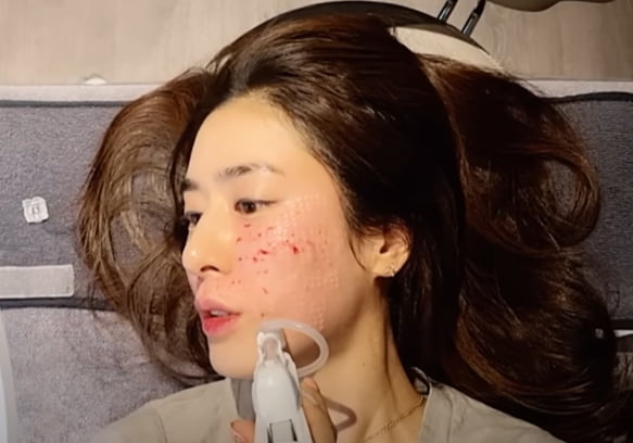 Min Hye-yeon's confident confession as a wife undergoing surgery while bleeding