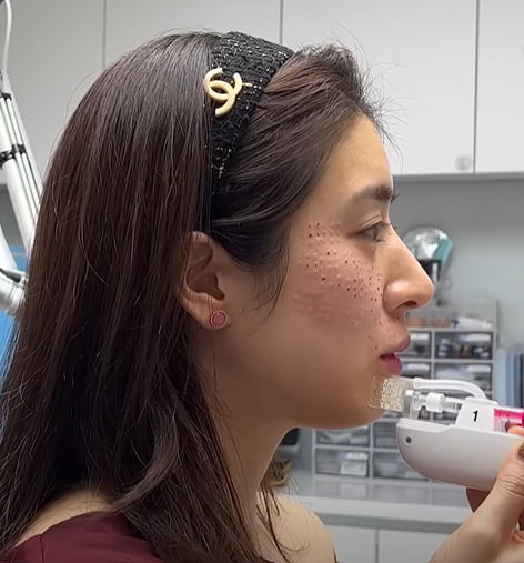 Min Hye-yeon's confident confession as a wife undergoing surgery while bleeding
