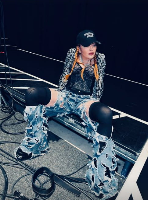 Madonna's face appears swollen two weeks after Grammy controversy