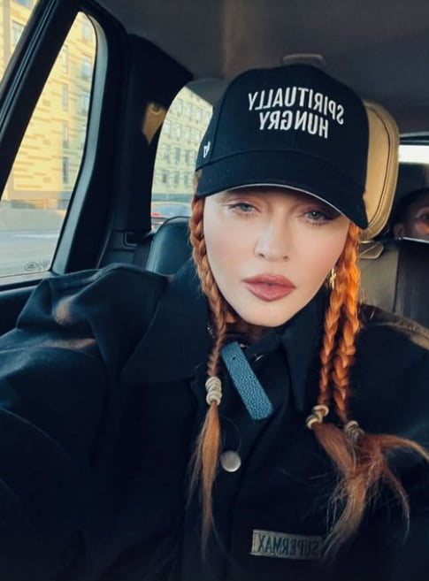 Madonna's face appears swollen two weeks after Grammy controversy