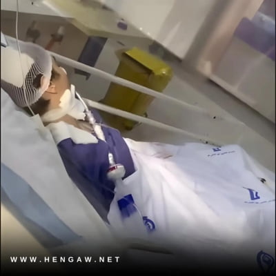 이란 소녀 혼수상태…인권단체 "히잡 문제로 도덕경찰과 실랑이"