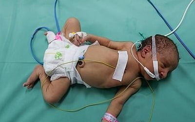 [이·팔 전쟁] 연료 바닥나는 병원들…"아기들 죽음 보고만 있을 건가"