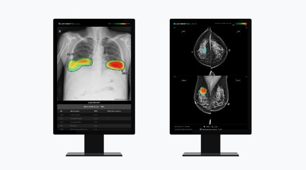 루닛 흉부 엑스레이 AI 영상분석 솔루션 '루닛 인사이트 CXR'(왼쪽)과 유방촬영술 AI 영상분석 솔루션 '루닛 인사이트 MMG' /사진제공=루닛