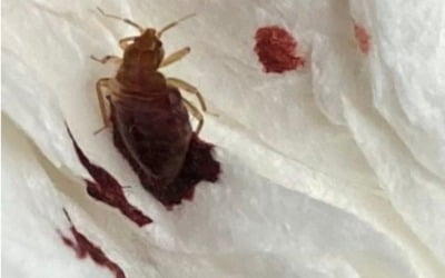 "살충제에도 안 죽는 이 벌레, 빈대인가요?"…전국 공포 확산