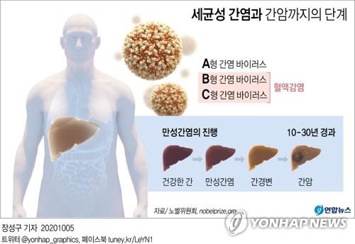 "간암 위험도, 간 수치 아닌 혈중 바이러스 수치가 영향"