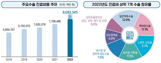 작년 백내장수술 가장 많이 받았다…가장 비싼 수술은 심장수술