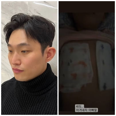 Yoo Hyeon-cheol worries about his daughter suffering from high fever