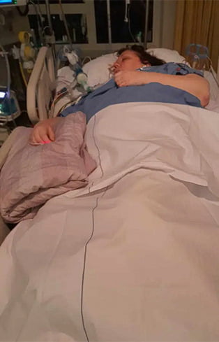 네덜란드의 59세 여성 트레이시 에글린이 병원에 입원해 치료를 받았다(왼쪽). 괴사성 근막염으로 엉덩이가 감염된 환자의 모습. /사진=뉴욕포스트·더 미러