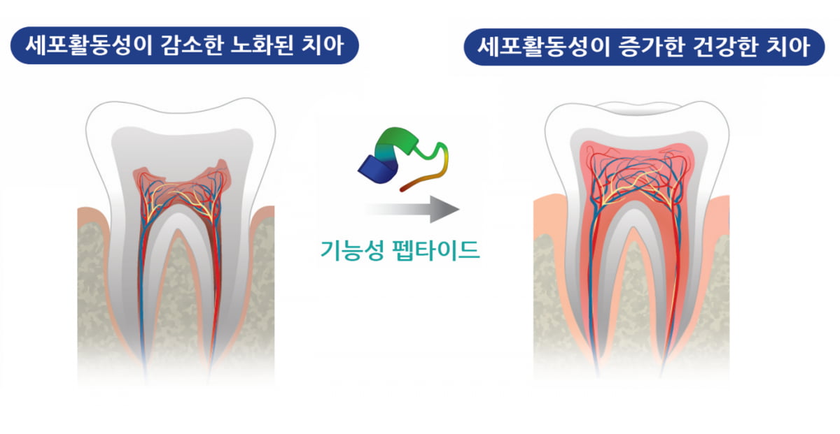 치아 항노화 단백질 발견, 치주질환 치료에 희망의 빛