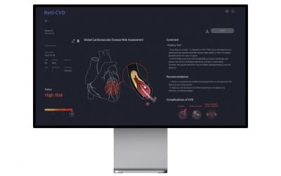 메디웨일, AI 심장질환 예측기기 ‘닥터눈’ 연세의료원 세브란스병원에 공급