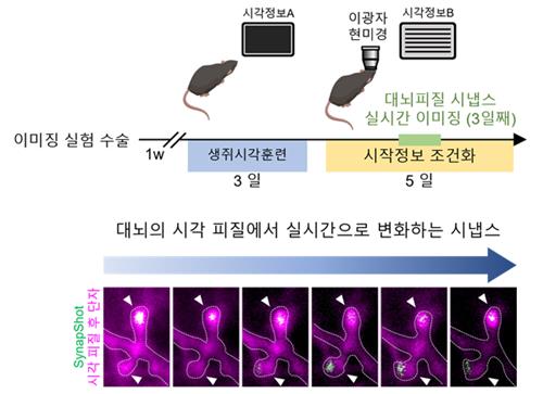 노화·질병으로 점점 변화하는 뇌, 실시간 관찰한다