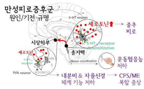 '행복 호르몬' 세로토닌 과활성이 만성피로증후군 부른다