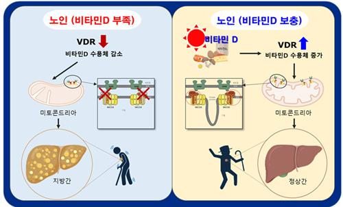 "비타민D, 노화로 인한 지방간 생성 억제"