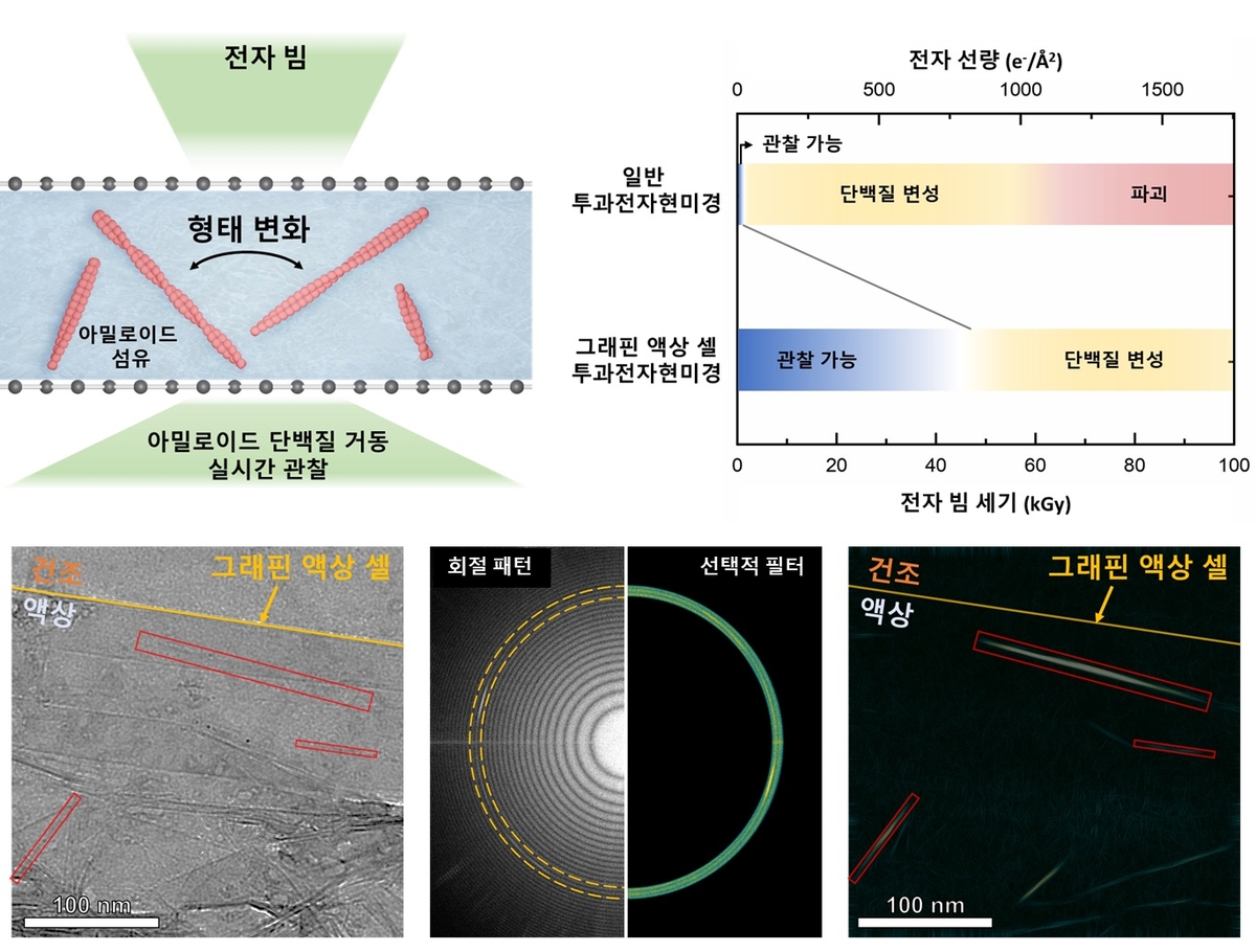 알츠하이머 유발 단백질 실시간 관찰 전자현미경 기술 개발