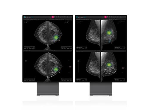 루닛, 美 의료기관에 유방암 검진 설루션 2종 공급