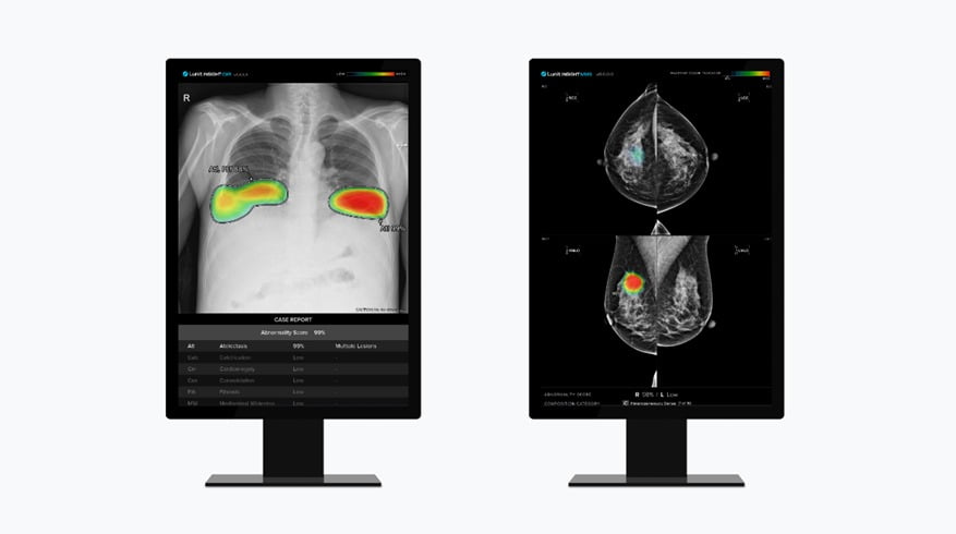 루닛 흉부 엑스레이 AI 영상분석 솔루션 ‘루닛 인사이트 CXR’(왼쪽) 및 유방촬영술 AI 영상분석 솔루션 ‘루닛 인사이트 MMG’./사진 제공=루닛