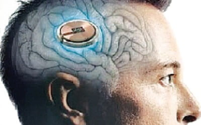  머스크의 문제적 실험…인간 뇌에 칩 심었다