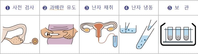 서울시, 가임기 여성 난자동결 지원 확대…20대 문턱 낮춰