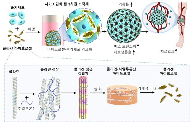 "중증 하지 허혈로 인한 다리 절단 막는 줄기세포 치료제 개발"