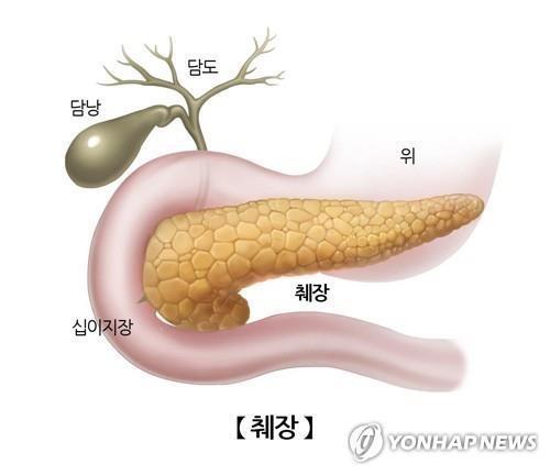 "췌장 지방 과다, 뇌 건강과 관계있다"