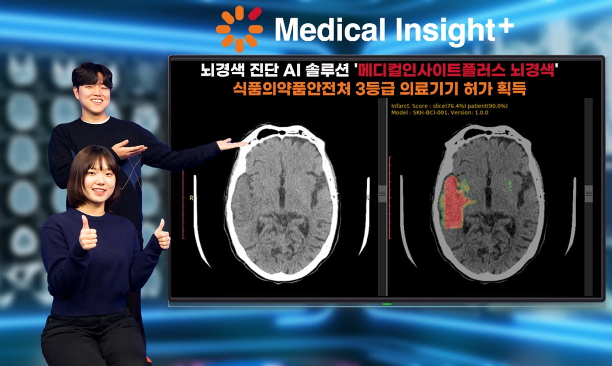 SK C&C, 뇌경색 진단 AI솔루션 식약처 허가 획득