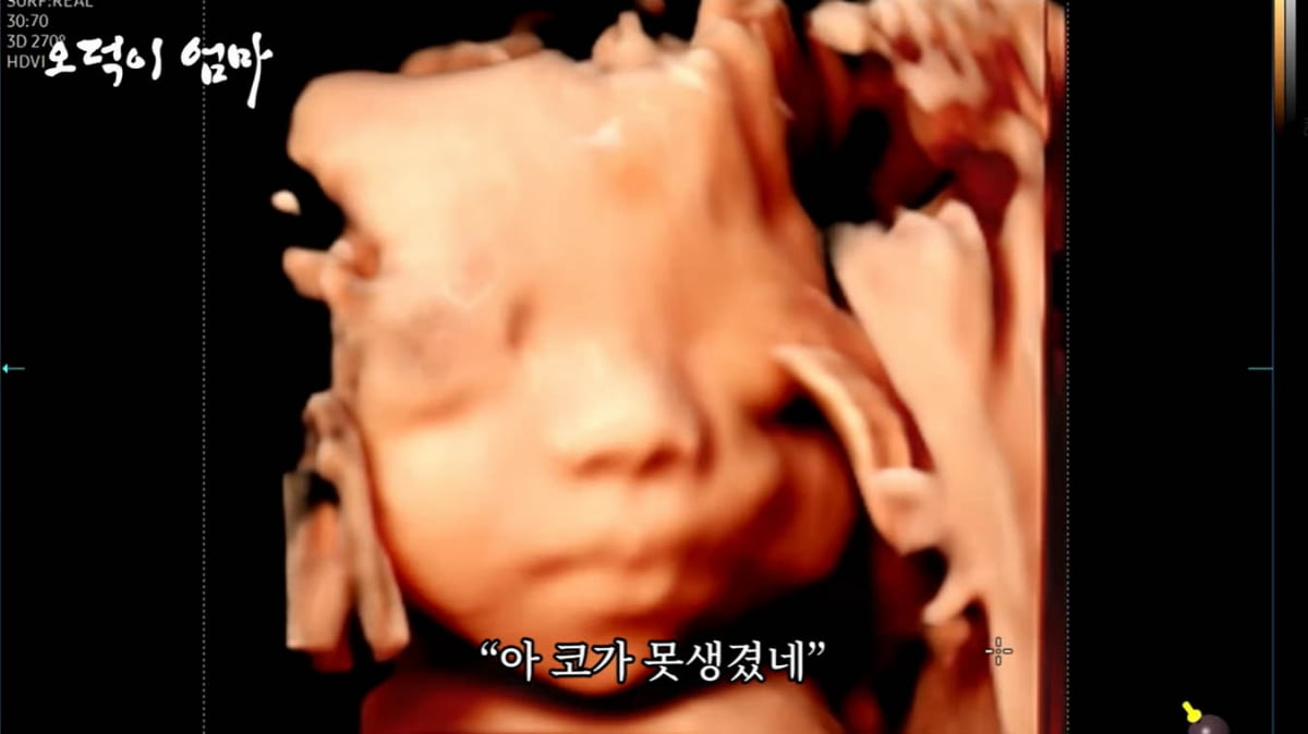 '임신 24주차' 황보라, 태아 초음파에 "코 못생겼다"('웤톸')