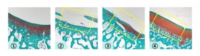 시지바이오, ‘히알루론산 겔’ 연골 재생 능력 입증