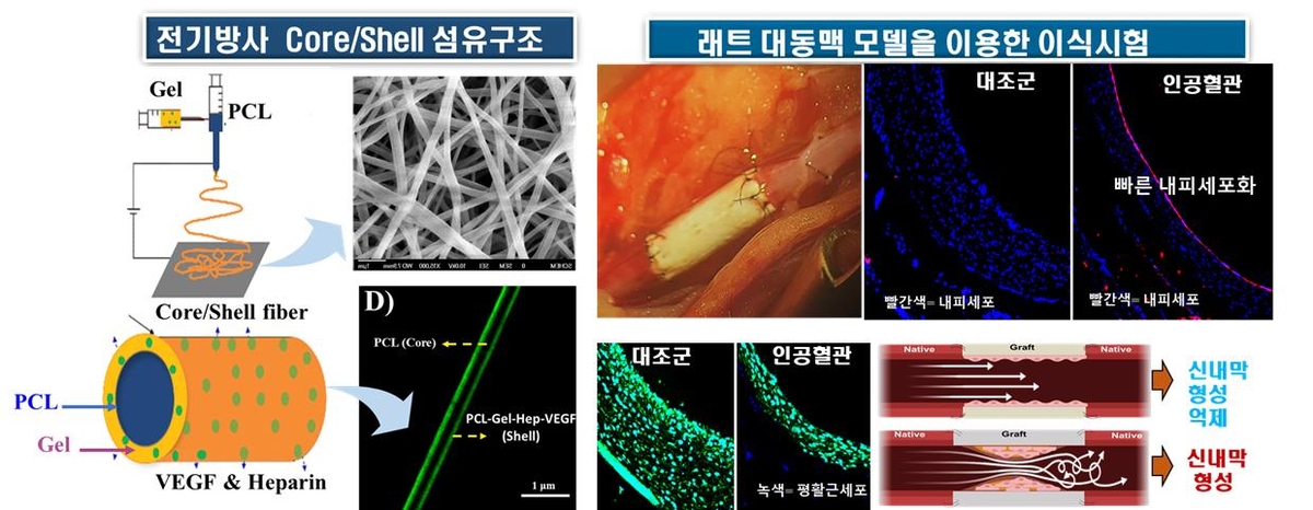 순천향대 의대 이병택 교수, 혈관 이식수술 위한 인공혈관 개발