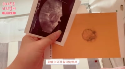 [종합] '박수홍♥' 김다예, 배아 이식 성공…초음파 사진에 "눈물 난다" ('행복해다홍')