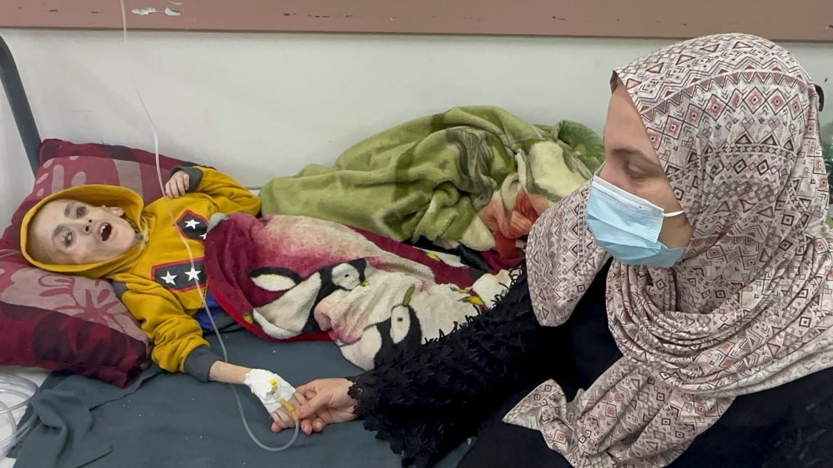 10일(한국시간) 미 일간 뉴욕타임스(NYT)는 영양실조 상황 속에서 사투를 벌이던 가자지구의 열 살 소년 야잔 카파르네가 지난 4일 숨졌다고 보도했다. 사진=REUTERS