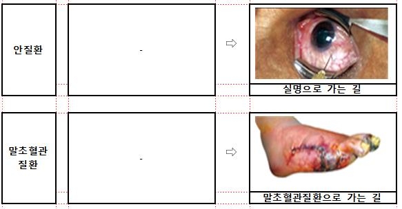 흡연 건강피해 경고 그림·문구 '더 다양하고 아프게' 바뀐다