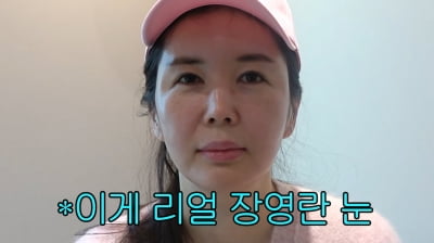 장영란, 눈 성형 받으러 병원行 "아이들은 몰라…♥한창은 허락"('A급 장영란')