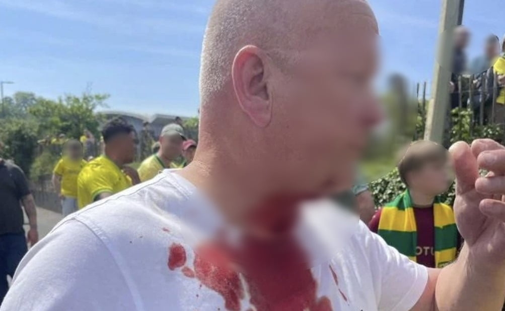 목에 칼이 찔린 한 리즈 팬. / 사진=텔레그레프 보도사진
