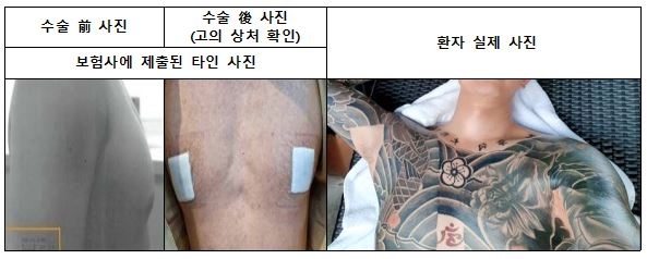 병원장이 '보험사기' 주도…허위수술 서류로 12억 챙긴 일당