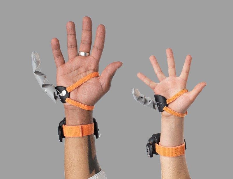 유럽연구진, 발가락으로 움직이는 '로봇 엄지손가락' 시험