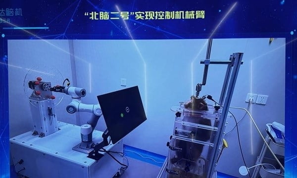 중국판 뉴럴링크 전격 '공개'…내년 인체실험 착수