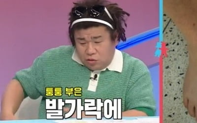 [종합] "다리 마비 왔다" 오정태, 충격적인 상태…"봉와직염으로 열 40도까지 올라" ('동상이몽2')